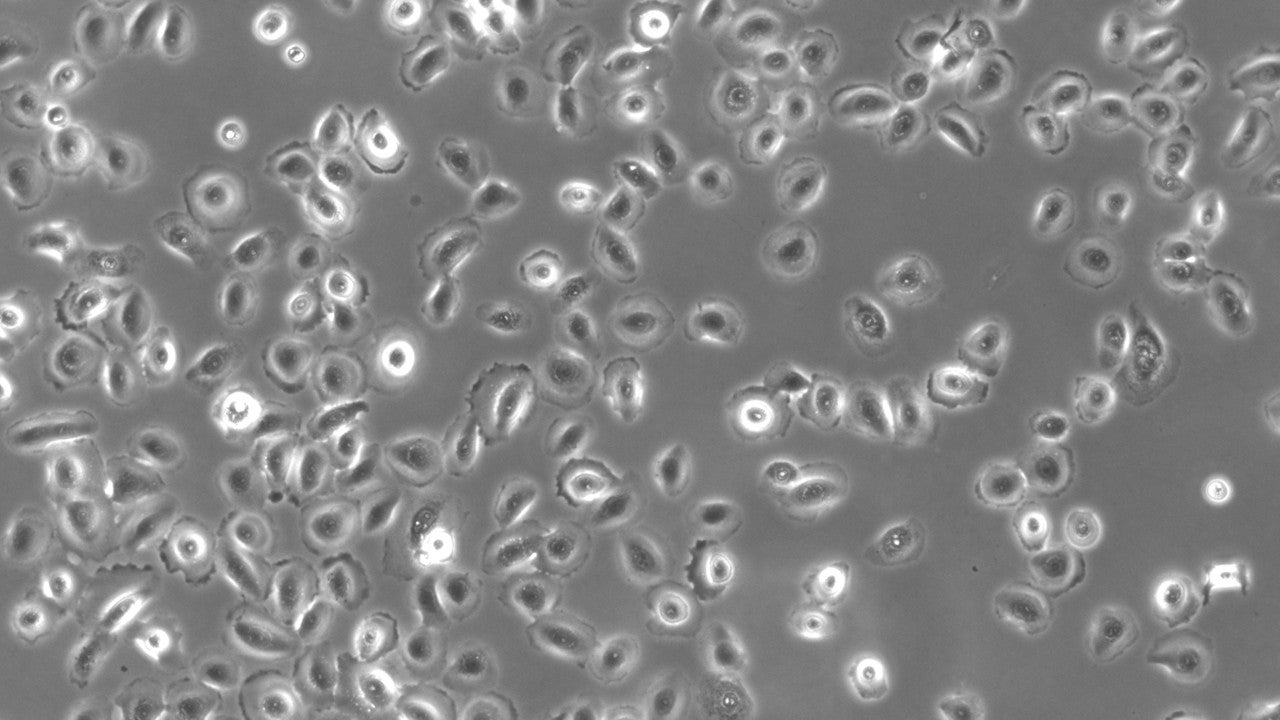 A micrograph of human bronchial epithelial cells grown in monolayer